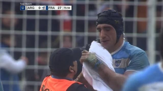 Argentine - France : Tomas Lavanini touché au visage.