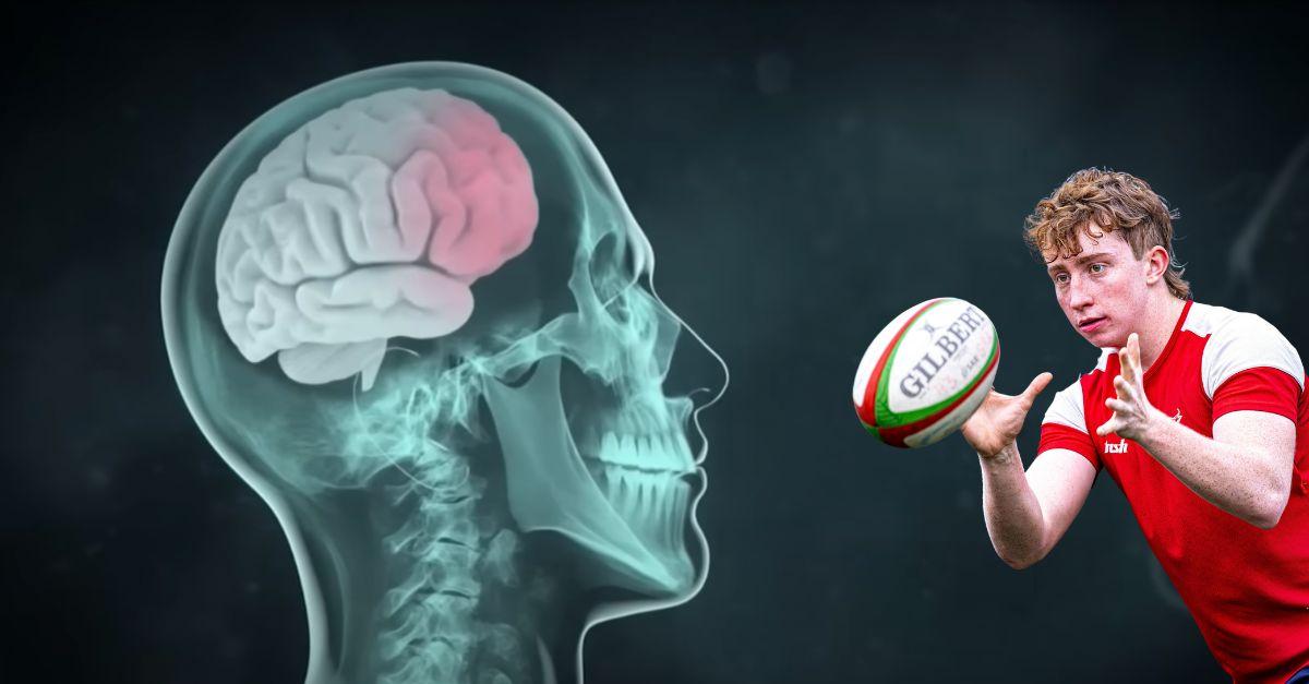 TOP 14. RUGBY. Commotions : ce que les joueurs vivent (vraiment) pendant le protocole