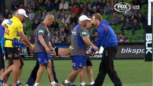 NRL - Encore un mince espoir pour Alex McKinnon?