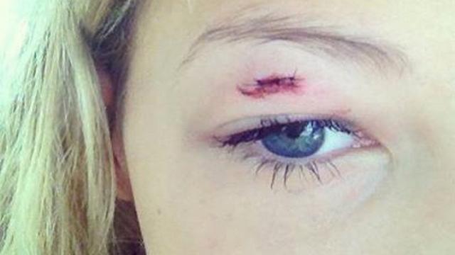 Les selfies-rugby, une fausse bonne idée ? / Crédit Photo : <a href='https://www.facebook.com/pages/Selfies-apr%C3%A8s-un-match-de-rugby/1488974671321544?ref=stream' target='_blank' rel='nofollow'>Page Facebook : Selfies après un match de rugby</a>